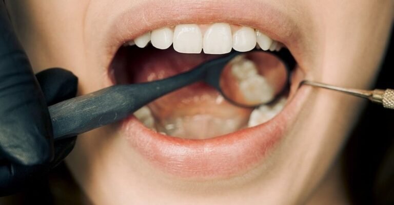 How To Have Whiter Teeth With Natural Methods